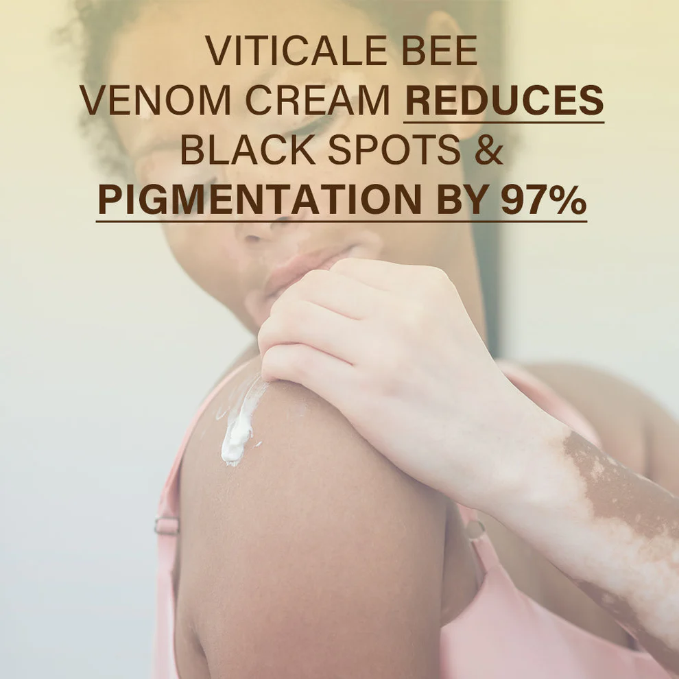 ATTDX® VitiClear Bee Venom Cream 5 ATTDX® VitiClear Bee Venom Cream