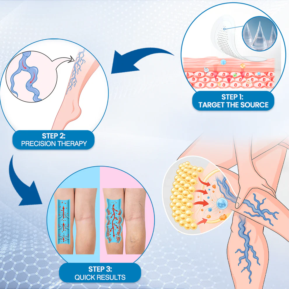 Ourlyard® VeinGuard Pain & Heaviness Microdarts Patch 5 Ourlyard® VeinGuard Pain & Heaviness Microdarts Patch