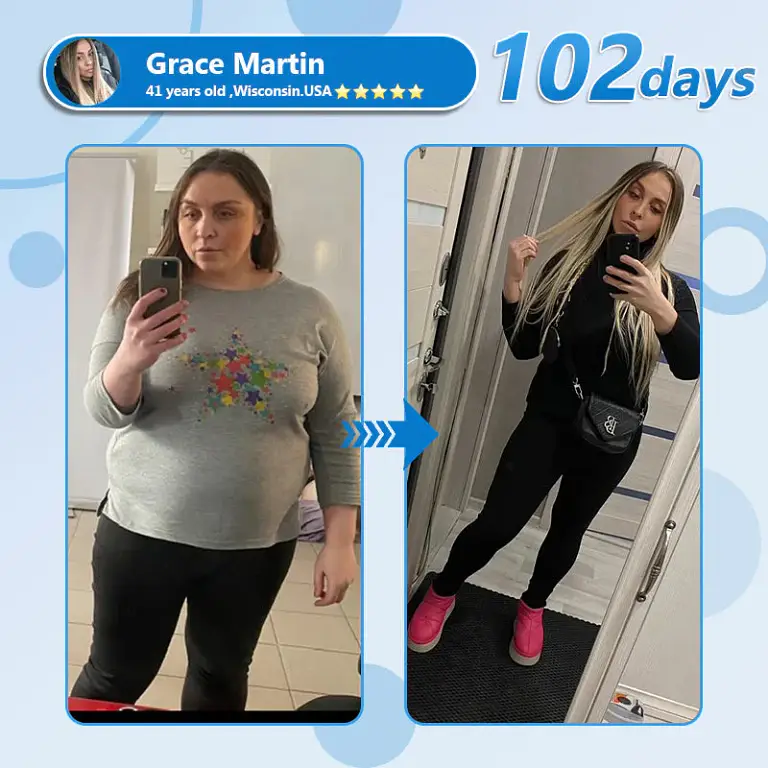 Croaie® NIDDK-Tirzepatide & Matrixyl 3000 Nano Microneedle Patch 7 Croaie® NIDDK-Tirzepatide & Matrixyl 3000 Nano Microneedle Patch