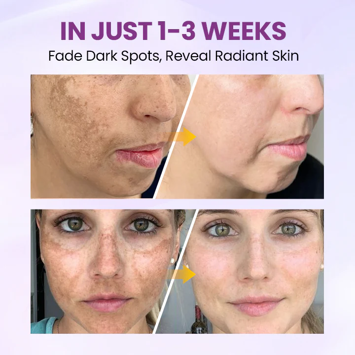 Clinclii™ Radiant Clear Blemish & Brightening Serum 3 Clinclii™ Radiant Clear Blemish & Brightening Serum