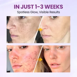 Clinclii™ Radiant Clear Blemish & Brightening Serum 11 Clinclii™ Radiant Clear Blemish & Brightening Serum