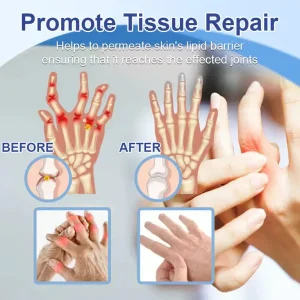 Skavix® Advanced Magnesium Pain Relief Cream 24 Skavix® Advanced Magnesium Pain Relief Cream