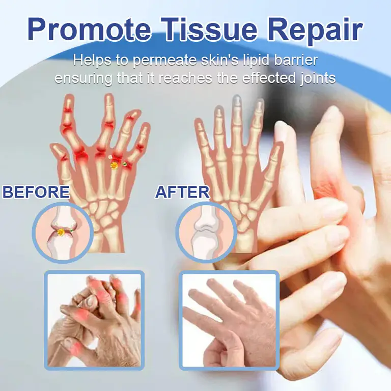 Skavix® Advanced Magnesium Pain Relief Cream 11 Skavix® Advanced Magnesium Pain Relief Cream