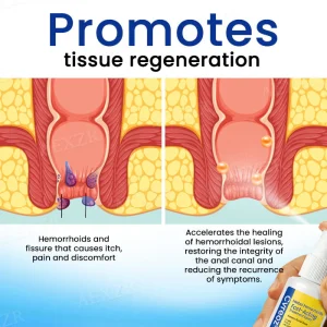Cvreoz® Herbal Hemorrhoids Fast-Acting Treatment Spray 10 Cvreoz® Herbal Hemorrhoids Fast-Acting Treatment Spray