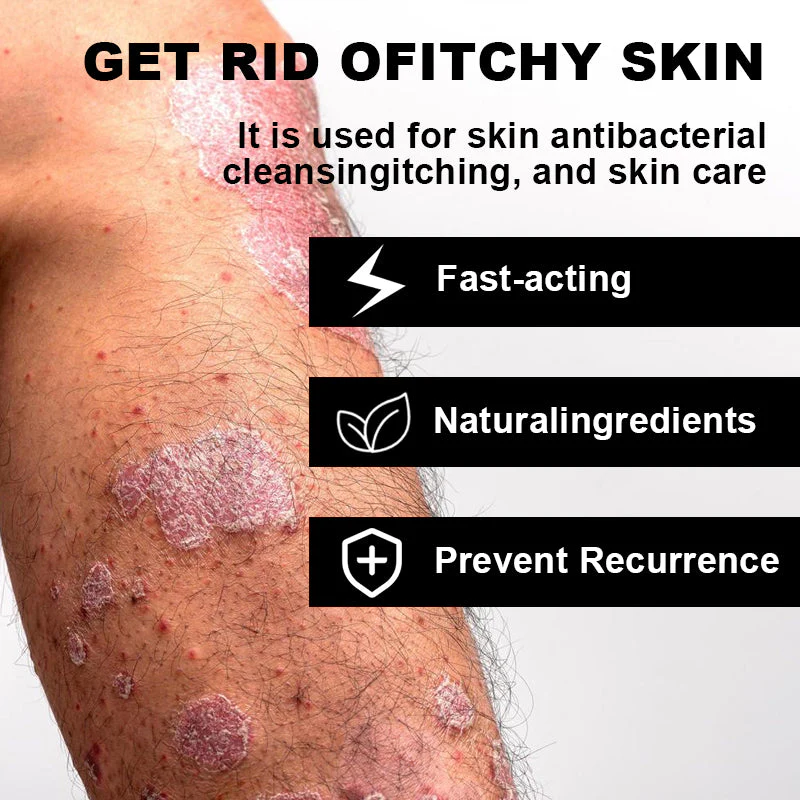 NESLEMY™ Psoriasis Cure Cream 6 NESLEMY™ Psoriasis Cure Cream