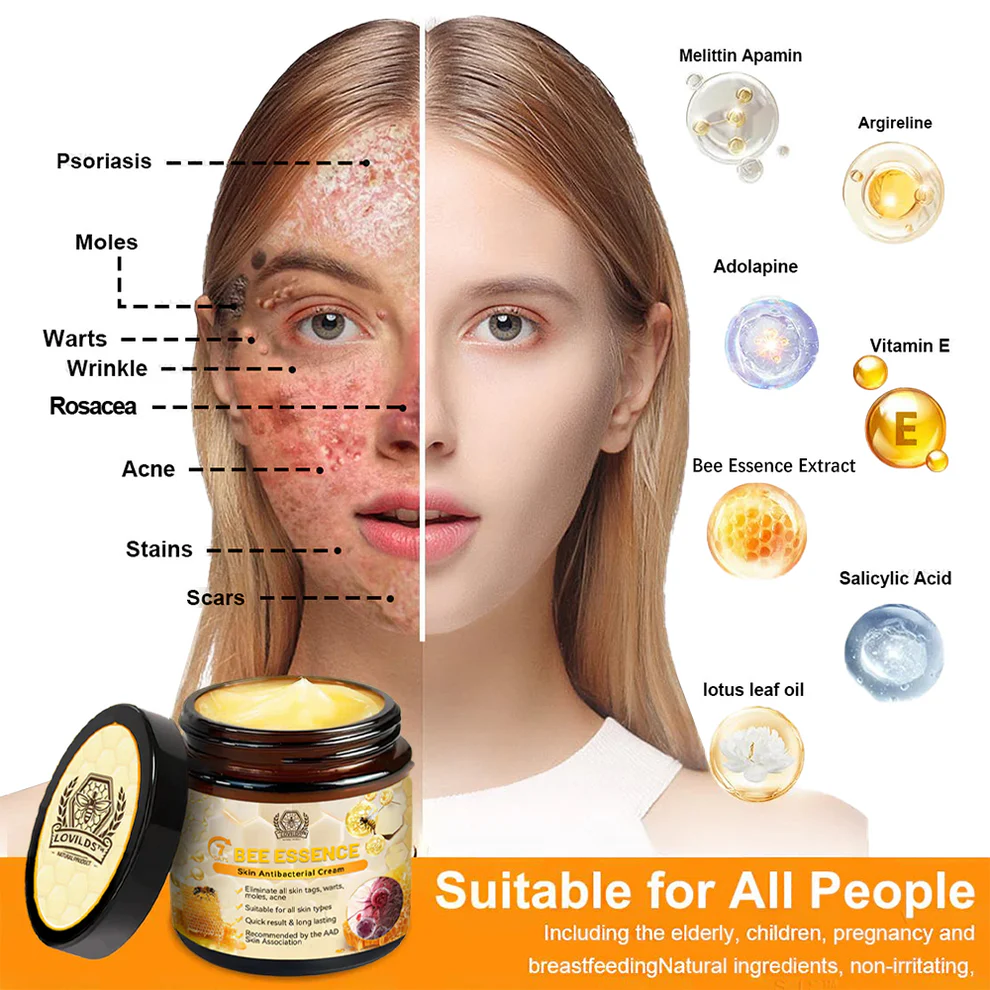 LOVILDS™ Bee Essence Skin Antibacterial Cream 4 LOVILDS™ Bee Essence Skin Antibacterial Cream