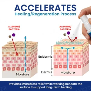 Cvreoz® Genital Treatment Spray 10 Cvreoz® Genital Treatment Spray