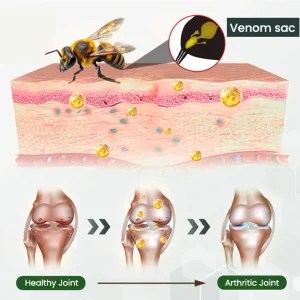 Adfire® Bee Venom Bone & Joint Revive Spray 13 Adfire® Bee Venom Bone & Joint Revive Spray