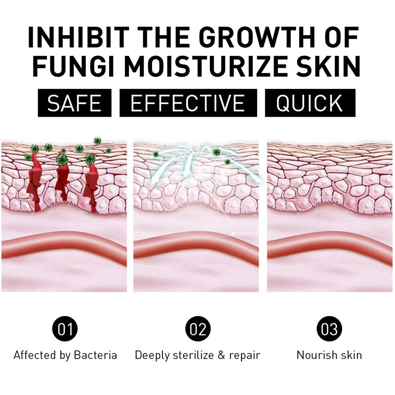 NESLEMY™ Psoriasis Cure Cream 5 NESLEMY™ Psoriasis Cure Cream