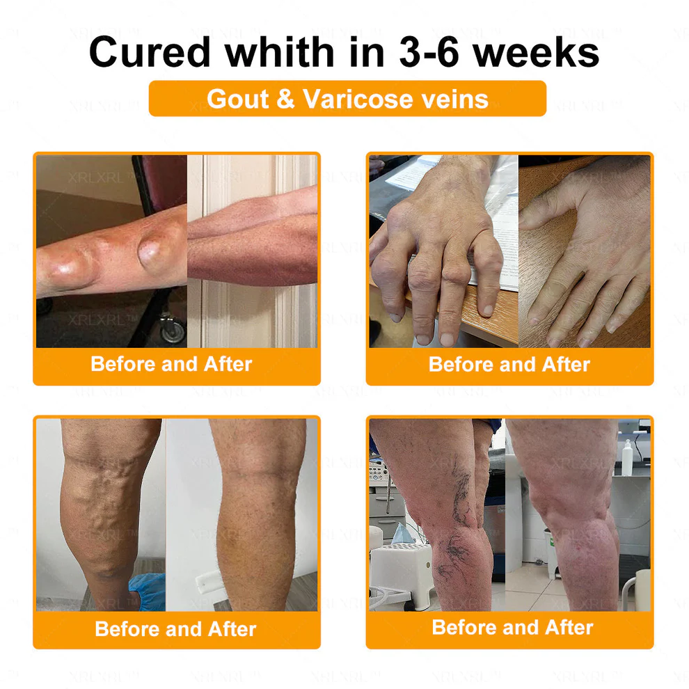 Jorondy® Bee Venom Pain-Relief Bone Healing Spray 7 Jorondy® Bee Venom Pain-Relief Bone Healing Spray