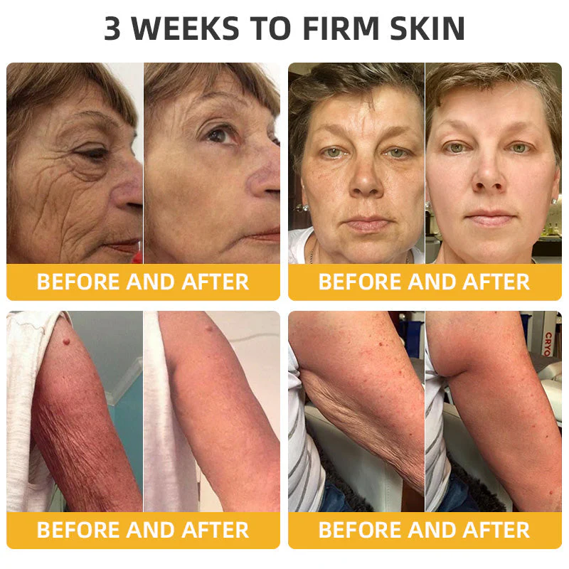 Turonu® Bee Venom Skin Remedy Cream 6 Turonu® Bee Venom Skin Remedy Cream