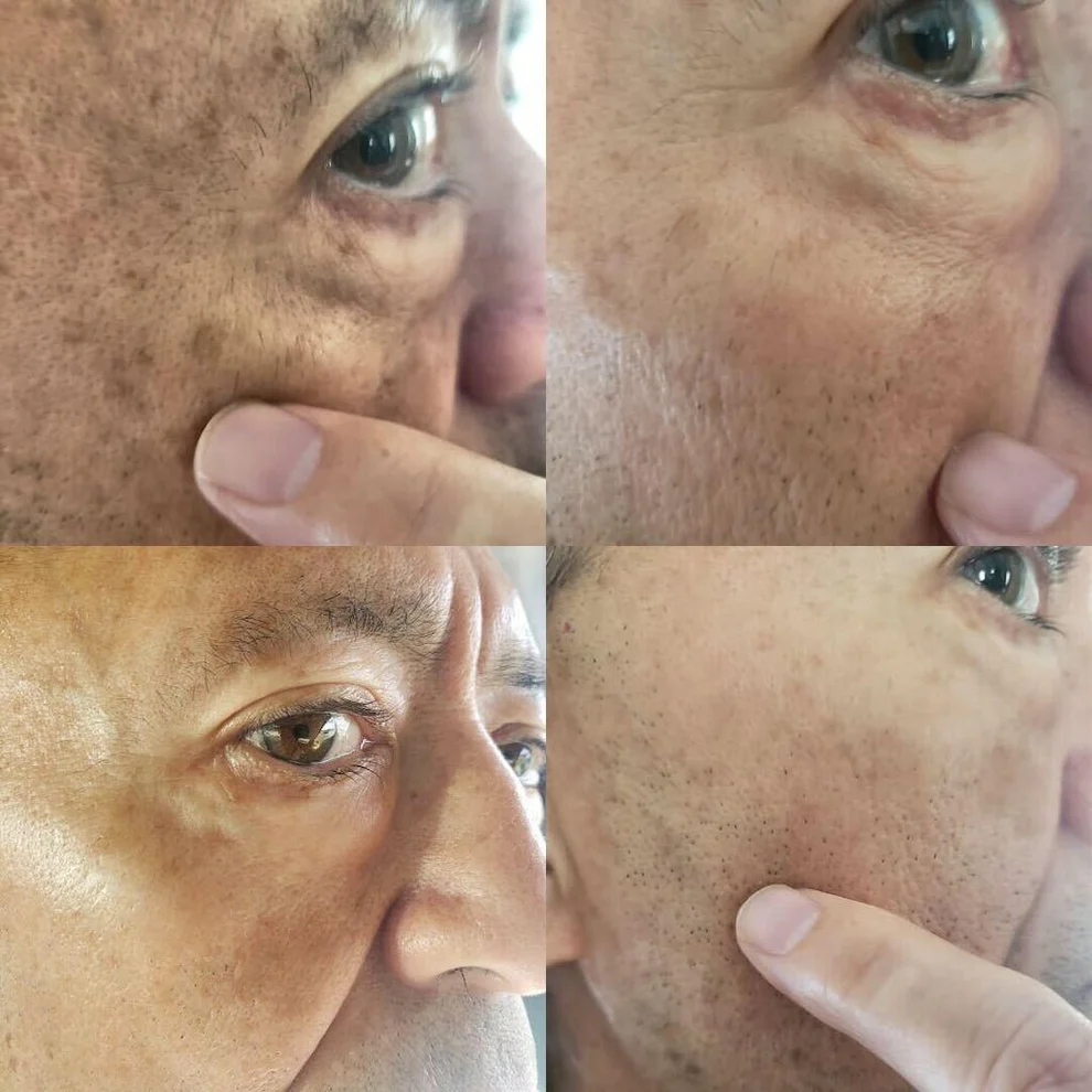 AQA™ Melanin Correcting Facial Serum 8 AQA™ Melanin Correcting Facial Serum