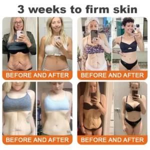 Flysmus™ Botox Bee Venom Firming Serum Stick 12 Flysmus™ Botox Bee Venom Firming Serum Stick