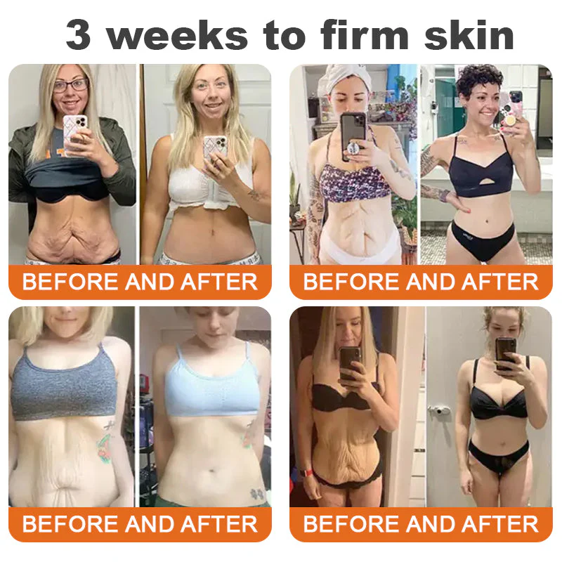 Flysmus™ Botox Bee Venom Firming Serum Stick 4 Flysmus™ Botox Bee Venom Firming Serum Stick