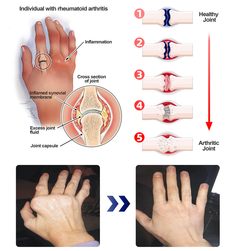 ADFIRE® Dual Action Joint Therapy Cream 3 ADFIRE® Dual Action Joint Therapy Cream