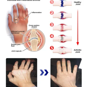 ADFIRE® Dual Action Pain Relief 14 ADFIRE® Dual Action Pain Relief