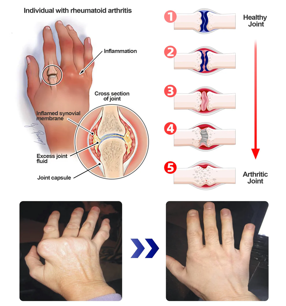 ADFIRE® Dual Action Pain Relief 3 ADFIRE® Dual Action Pain Relief