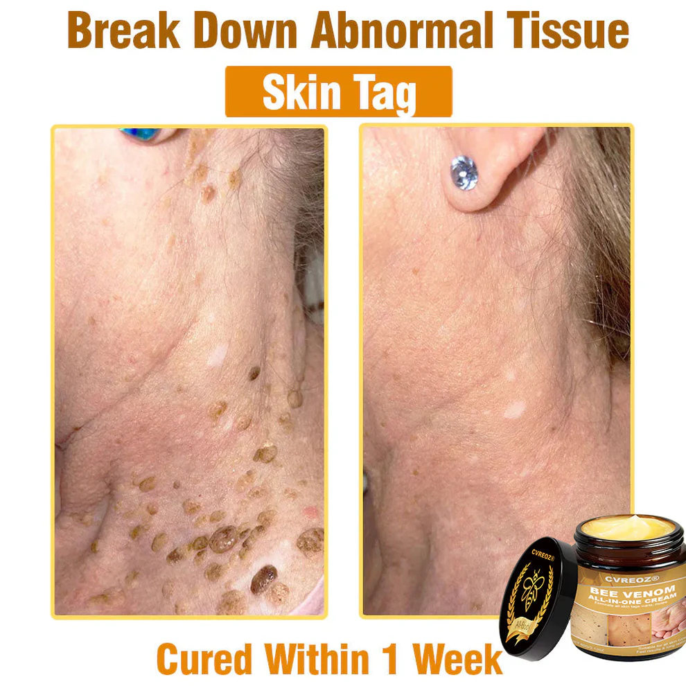 Cvreoz® Bee Venom All-in-One Cream 11 Cvreoz® Bee Venom All-in-One Cream