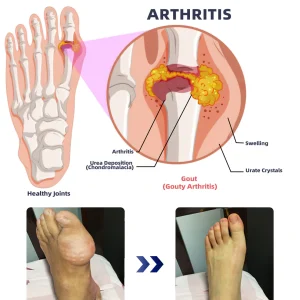 ADFIRE® Dual Action Joint Therapy Cream 15 ADFIRE® Dual Action Joint Therapy Cream