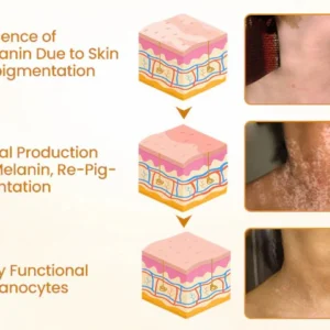 Newyuo® VitiCalm Bee Venom Cream 13 Newyuo® VitiCalm Bee Venom Cream