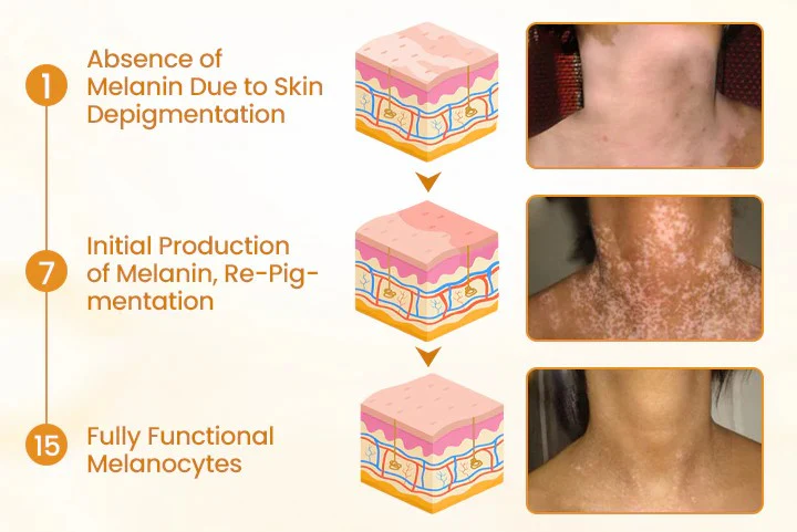 Newyuo® VitiCalm Bee Venom Cream 4 Newyuo® VitiCalm Bee Venom Cream