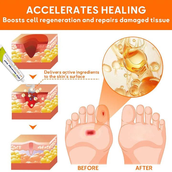 LAOZIK™ DFU Synergy Gel 7 LAOZIK™ DFU Synergy GelLAOZIK™ DFU Synergy Gel