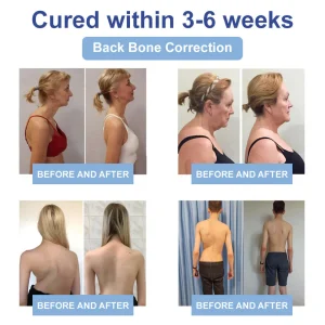 Grunsify® NIDDK-Tirzepatide Nano Patch