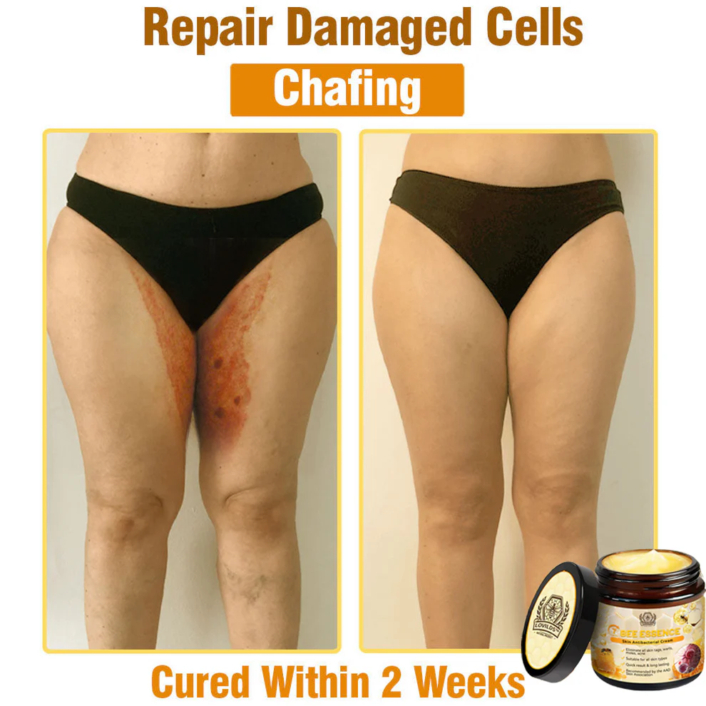 LOVILDS™ Bee Essence Skin Antibacterial Cream 10 LOVILDS™ Bee Essence Skin Antibacterial Cream