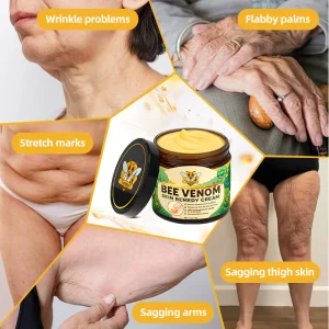 Turonu® Bee Venom Skin Remedy Cream 23 Turonu® Bee Venom Skin Remedy Cream