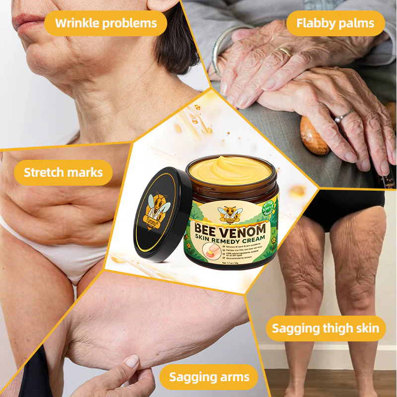 Turonu® Bee Venom Skin Remedy Cream 11 Turonu® Bee Venom Skin Remedy Cream
