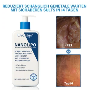 Oveallgo® Exclusive NanoLipo HPV Genital Wart Eraser Cream 9 Oveallgo® Exclusive NanoLipo HPV Genital Wart Eraser Cream