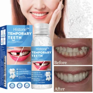 Histone™ Natural Tooth Repair Gel