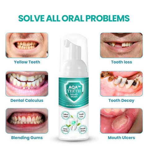AQA™ NEW TEETH Mouthwash - Solve all Oral Problems 4 AQA™ NEW TEETH Mouthwash - Solve all Oral Problems