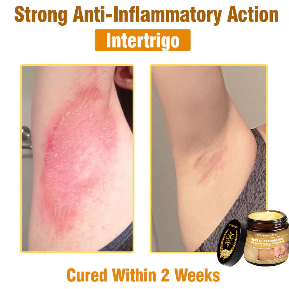 Cvreoz® Bee Venom All-in-One Cream 8 Cvreoz® Bee Venom All-in-One Cream