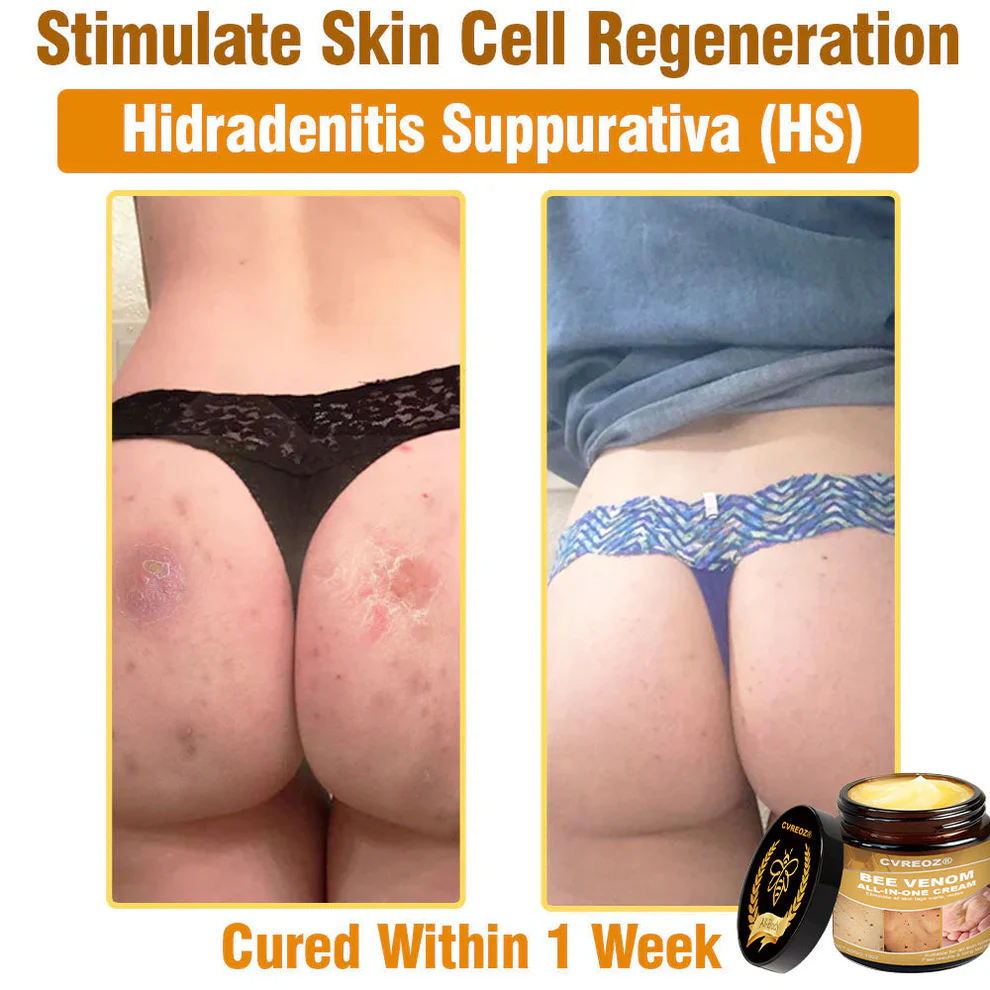 Cvreoz® Bee Venom All-in-One Cream 7 Cvreoz® Bee Venom All-in-One Cream