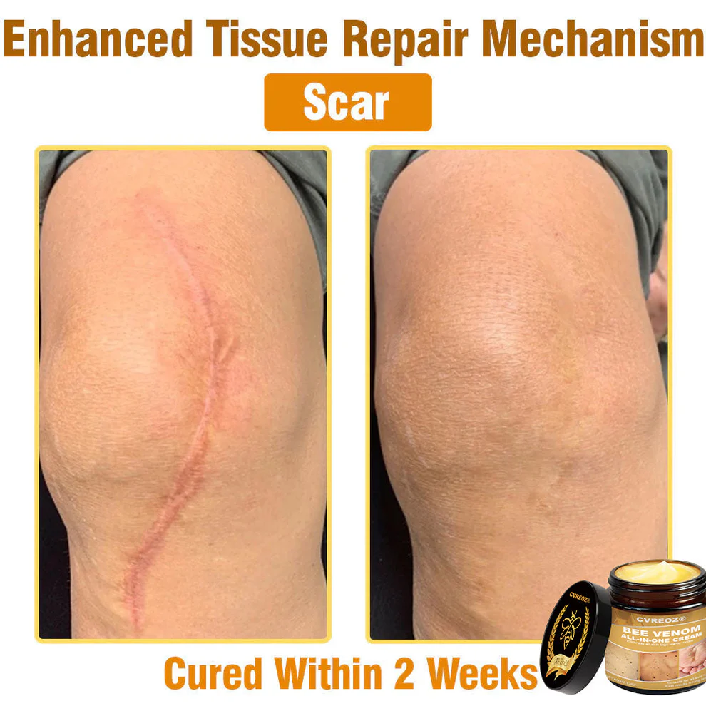 Cvreoz® Bee Venom All-in-One Cream 6 Cvreoz® Bee Venom All-in-One Cream