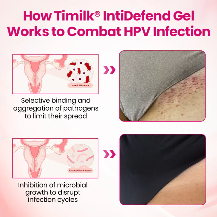 Timilk® IntiDefend Anti-HPV Interferon Gel 3 Timilk® IntiDefend Anti-HPV Interferon Gel