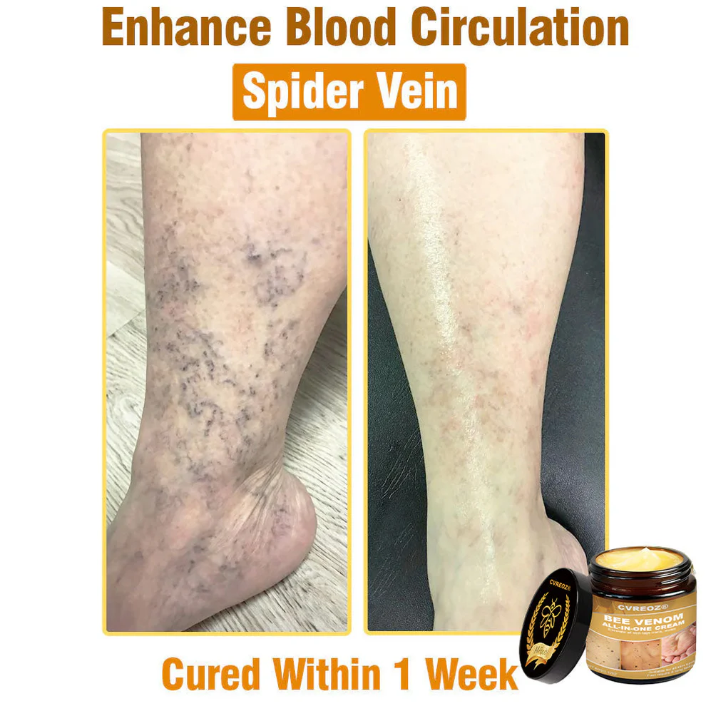 Cvreoz® Bee Venom All-in-One Cream 3 Cvreoz® Bee Venom All-in-One Cream