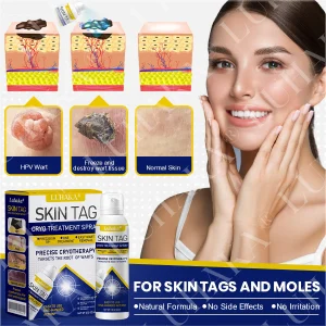 LUHAKA® SKIN TAG CRYO TREATMENT SPRAY ACE 16 LUHAKA® SKIN TAG CRYO TREATMENT SPRAY ACE