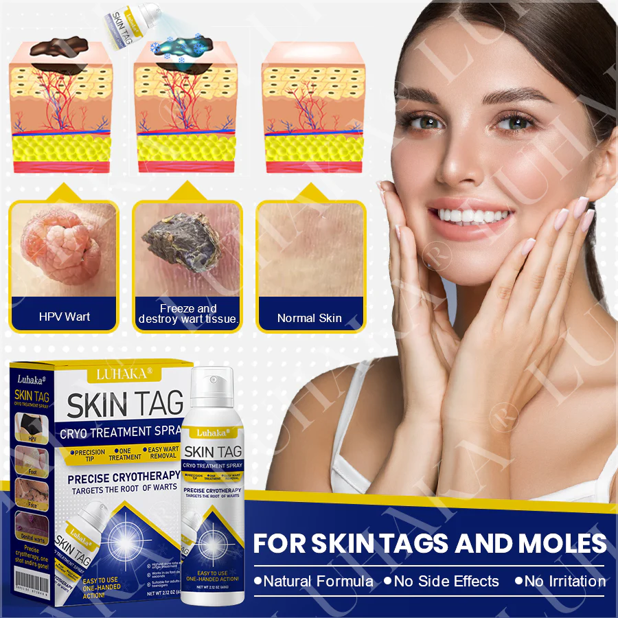 LUHAKA® SKIN TAG CRYO TREATMENT SPRAY ACE 8 LUHAKA® SKIN TAG CRYO TREATMENT SPRAY ACE