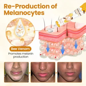 Newyuo® VitiCalm Bee Venom Cream 19 Newyuo® VitiCalm Bee Venom Cream