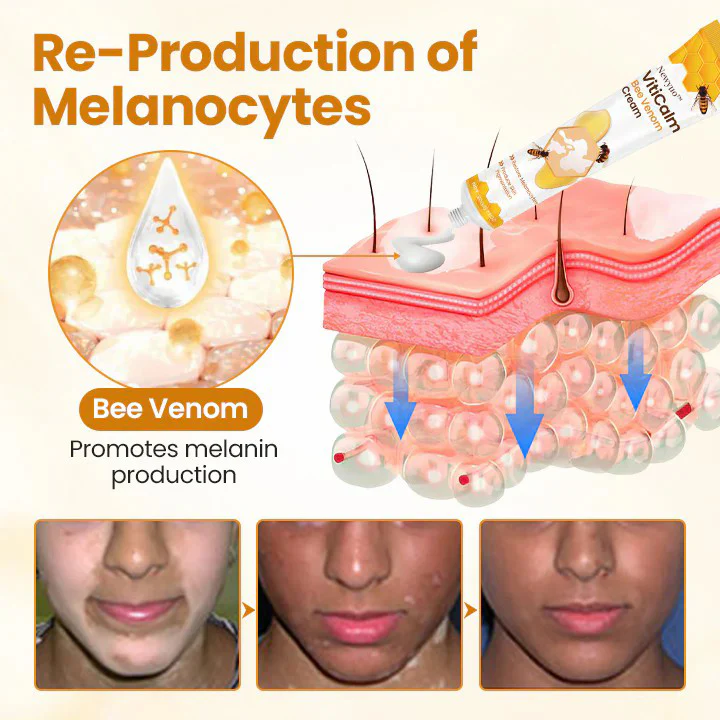 Newyuo® VitiCalm Bee Venom Cream 10 Newyuo® VitiCalm Bee Venom Cream