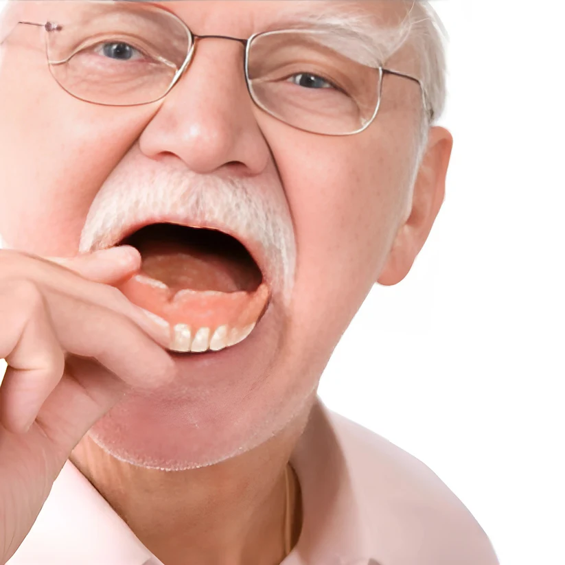 Glamoara™ - Denture Set 5 Glamoara™ - Denture Set