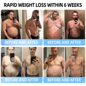 Croaie® NIDDK-Tirzepatide & Matrixyl 3000 Nano Microneedle Patch 24 Croaie® NIDDK-Tirzepatide & Matrixyl 3000 Nano Microneedle Patch