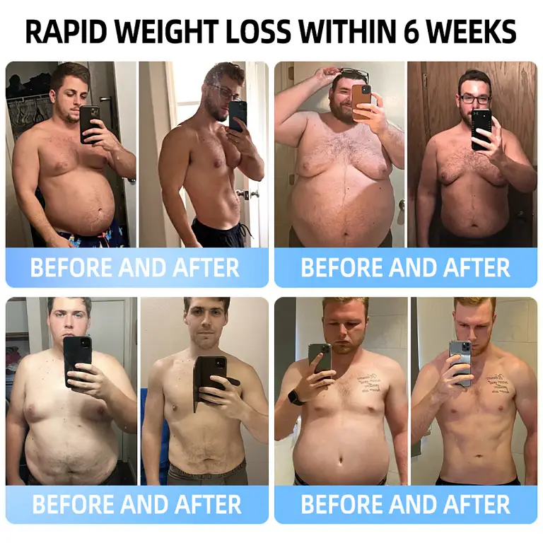 Croaie® NIDDK-Tirzepatide & Matrixyl 3000 Nano Microneedle Patch 12 Croaie® NIDDK-Tirzepatide & Matrixyl 3000 Nano Microneedle Patch