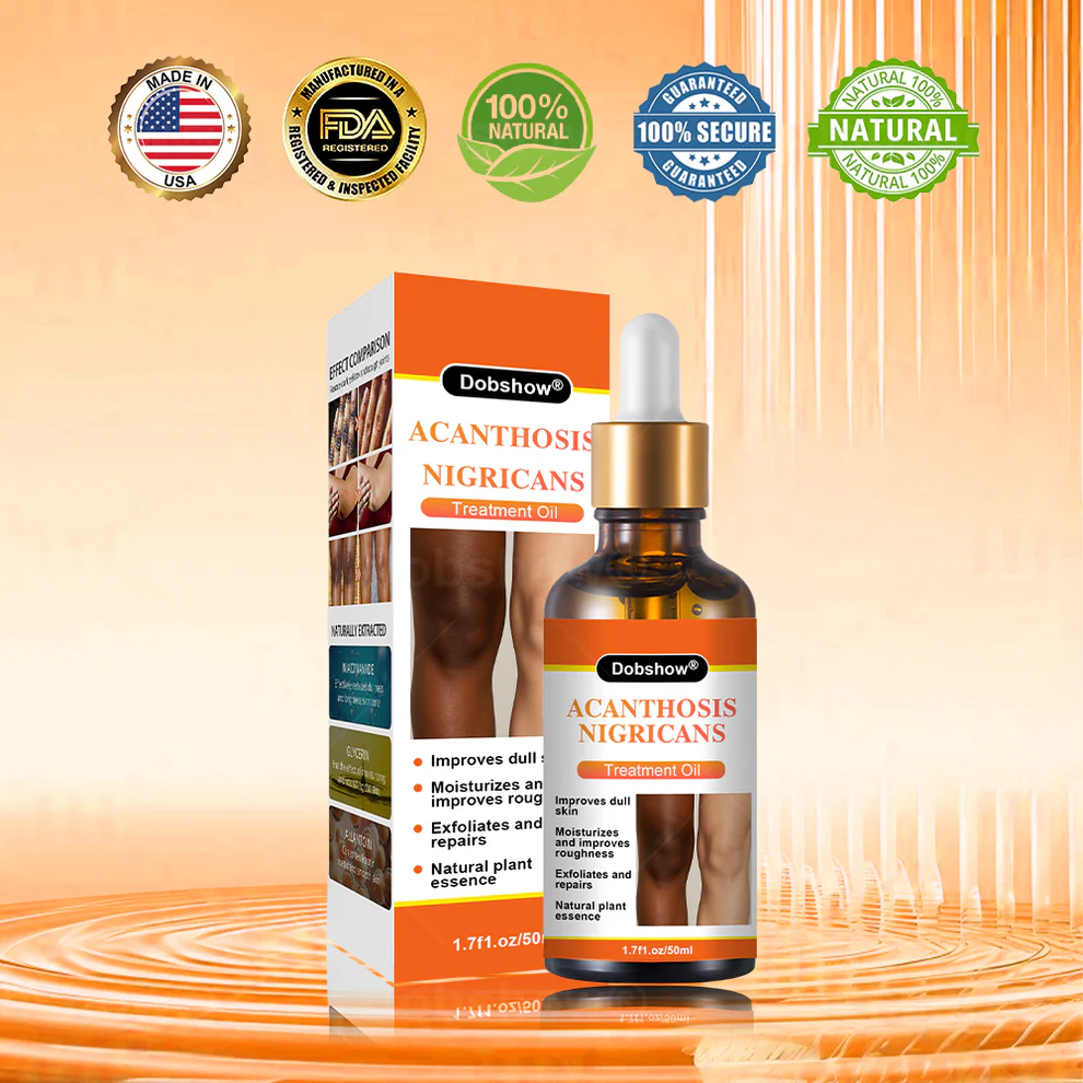 Dobshow® Acanthosis Nigricans Treatment Oil 1 Dobshow® Acanthosis Nigricans Treatment Oil
