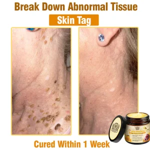 LOVILDS™ Bee Essence Skin Antibacterial Cream 18 LOVILDS™ Bee Essence Skin Antibacterial Cream