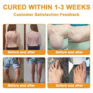 ZVLZVL® Bee Venom Pain-Relief Bone Healing Cream 21 ZVLZVL® Bee Venom Pain-Relief Bone Healing Cream