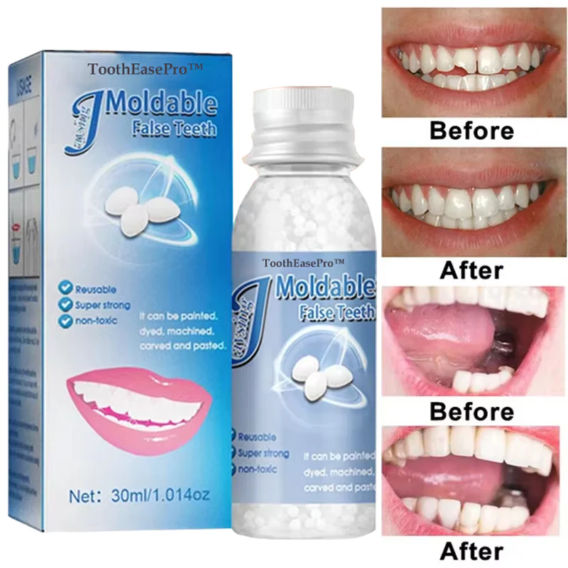 ToothEasePro™ Dental Filling Gel 6 ToothEasePro™ Dental Filling Gel