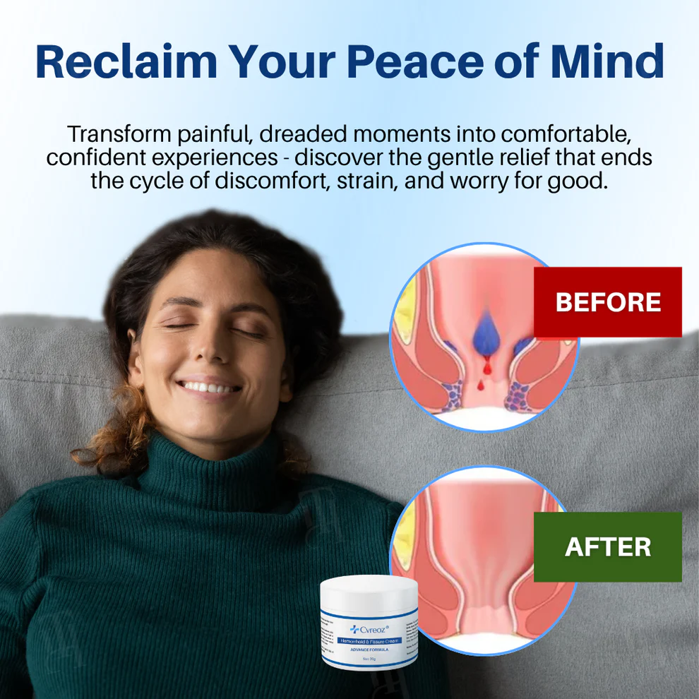 Cvreoz® Hemorrhoid & Fissure Cream 8 Cvreoz® Hemorrhoid & Fissure Cream